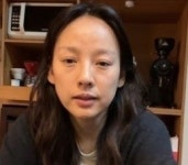 이효리 “쟁반노래방때 보톡스 맞았는데…부자연스러워”