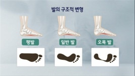 맨발 걷기 열풍, 안전하게 걷고 계십니까?…‘맨발 걷기’ 독이 되는 사람은?[생로병사의 비밀]