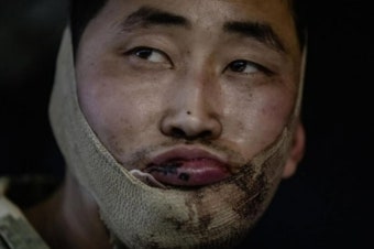 젤렌스키 “북한군 포로 사진 공개”...언론에 수감자 접근 허용하며 여론전