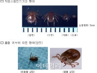 살인 진드기 바이러스 국내서도 발견