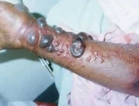 에볼라 공포에 전세계가 `벌벌`..한국도 영향권