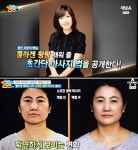 뷰티피아 이경희 원장, `나는 몸신이다` 출연..젊어지는 `잔스 경락법` 소개