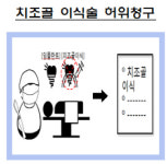 금감원 “임플란트 보험사기 조심하세요”