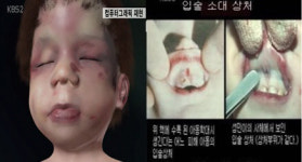 “장 끊어진 채 고통 속에 숨져”…‘성민이 사건’ 靑 대답 듣는다