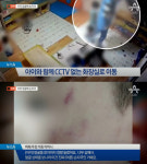 “아이 얼굴에 선명한 손자국”…중랑구 어린이집서 아동학대 의혹