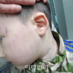 교사가 세살짜리 뺨을…또 불거진 서울형 어린이집 아동학대 의혹