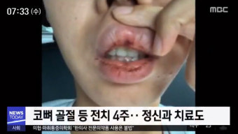 폭행 당한 女운전자, 직접 가해자 파악…경찰 늦장 대응