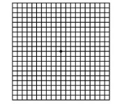 설 영휴, 온 가족 모인 자리에서 눈 건강 확인해볼까?