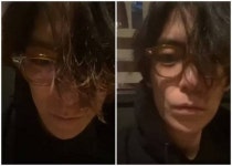빅뱅 탑, 뜬금없는 만취 라이브… 