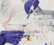 SK바이오팜, CNS 치료제 글로벌 강자로 부상하나