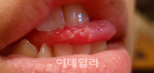 유명 호텔 생수병서 락스가..죽을 뻔했습니다