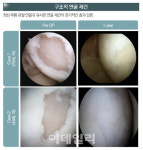 박지성 현역이면 33세 은퇴 없다...엘앤씨바이오, 무릎연골 치료 판도 바꾼다