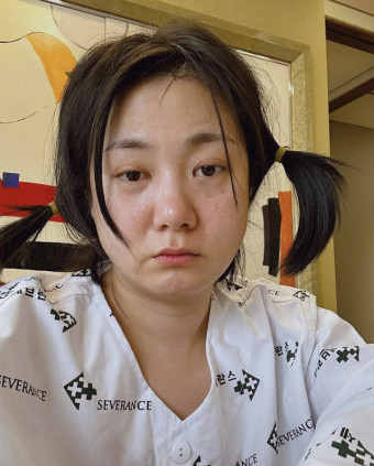 '나혼산' 불참 박나래, 성대수술 받았다…