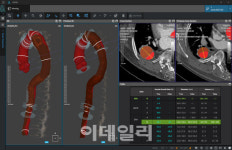코어라인소프트, ‘대동맥 박리 진단 보조’ SW 혁신의료기기 지정