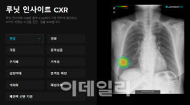 [단독] 루닛, AI 흉부 X-ray 韓 첫 판매 돌입...무주공산 900억 시장 잡는다