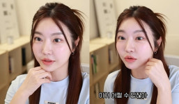 레이디제인, 달라진 얼굴?…쌍꺼풀 수술, 10분 만에 끝나