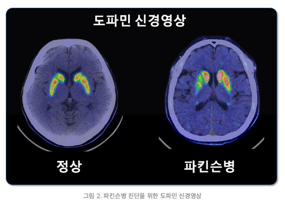 박보검, 굿보이 촬영 중 실신…파킨슨병 가능성 대두
