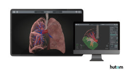 휴톰, 글로벌 의료기기 전시회 ‘MEDICA 2025’ 참가