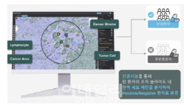 파트너 네트워크 확대하는 루닛...1위 수성 로드맵은⑦[1등 K바이오]