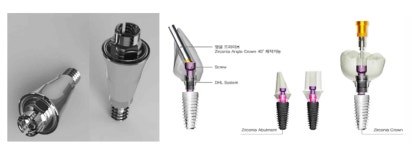 임플란트계 TSMC 꿈꾼다…시지메드텍, 브랜드로 증명하고 CDMO로 폭주