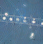 영하196℃서 혈액 결빙막는 물질…남극 돌말서 찾았다
