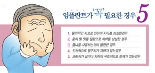 임플란트치료 잘받는법 -“임플란트, 맞춤진료를 선택하자”