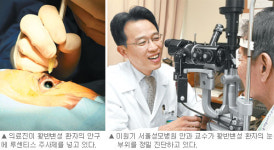 [헬스&뷰티/Before & After]서울성모병원 안과 황반변성 치료