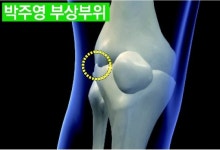 박주영 골뒤풀이중 무릎서 ‘뚝’소리