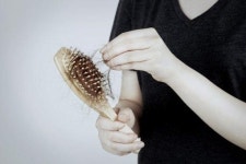 “부장님, 참고해주세요”… 직장인, 탈모 부르는 순간은?