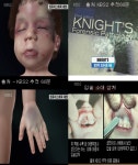 어린이집 영·유아 사망사고 속출, 11년 전 ‘성민이 사건’ 수면 위로