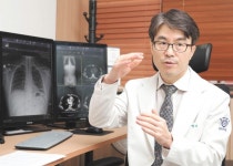 건강검진서 발견한 담석… 담낭을 어찌할까?