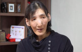 ‘거인병 투병’ 농구스타 김영희 별세…향년 60세