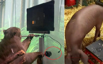“뇌에 컴퓨터 칩 이식할 분?”…머스크의 뉴럴링크, 첫 임상시험 참가자 모집