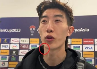 호주전서 선방 보여준 조현우…‘얼굴, 목 붉은 두드러기’ 부상투혼