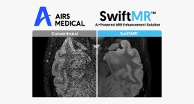 에어스메디컬, 獨·英·日에 MRI AI 솔루션 SwiftMR™ 공급 계약 체결