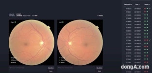 “CT 대신 눈 검사로 심혈관질환 진단”… 동아ST, 메디웨일과 AI 헬스케어 사업 협력