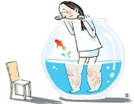 하지정맥류, 다리 정맥 이상 따른 혈액 역류