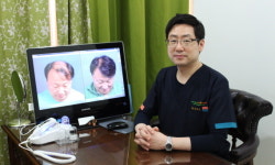 수요 높아진 모발이식, ‘생착률’이 관건이다