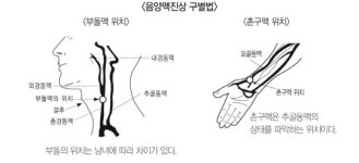 “당뇨 손가락 채혈, 위치도 중요”