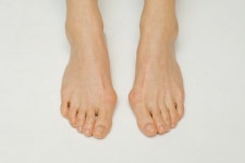 하이힐·킬힐 아름다운만큼 발에 치명적