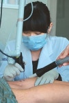 튼살, 레이저 쏘면 새살 돋는다