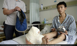 자라는 발만큼 커지는 두려움…저도 걷고 싶어요