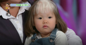 안녕하세요 백색증 걸린 4살 아이에게 어른들이 준 상처
