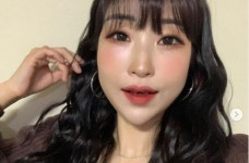 ‘눈이 10시10분’ 악플에 상처받았다는 이세영에 성형외과 의사 “10시15분으로 만들어주겠다”