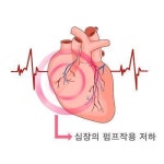 “‘심장 주위 지방’ 과다하면 심부전 위험 높아져”