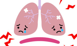 60대 흡연자 폐암 발생률, 20대의 68배↑