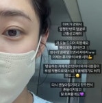 최희, 안면마비 올 정도 스트레스 심했나…“이제는 혼자와의 싸움”