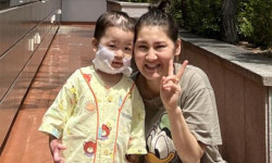 마당서 뛰던 몽골아이, 끓는 우유통에 ‘풍덩’… 국내 의료진 무상 치료로 회복