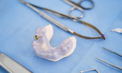 치료 중 떨어진 핀셋에 전치 20주… 과실치상 치위생사 집행유예