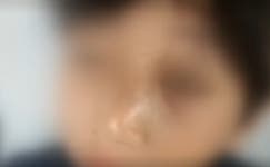 “주먹에 맞아 코뼈 부러져, 1시간 넘게 수술받아”…태권도장 또 아동학대 의혹